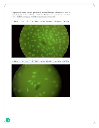 Luego después de los controles pasamos las muestras las cuales dan negativas hasta el
suero 42 el cual resulta positivo y se realizan 3 diluciones, de las cuales solo usaremos
1/160 y 1/320. Las imágenes obtenidas se muestran a continuación.

SUERO 12, NEGATIVO, HOMOGENEO INESPECIFICO (IMAGEN 6)

SUERO 22, NEGATIVO, HOMOGENEO INESPECIFICO (IMAGEN 7)

10

 