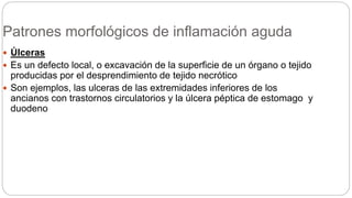Patrones morfológicos de inflamación aguda
 Úlceras
 Es un defecto local, o excavación de la superficie de un órgano o tejido
producidas por el desprendimiento de tejido necrótico
 Son ejemplos, las ulceras de las extremidades inferiores de los
ancianos con trastornos circulatorios y la úlcera péptica de estomago y
duodeno
 