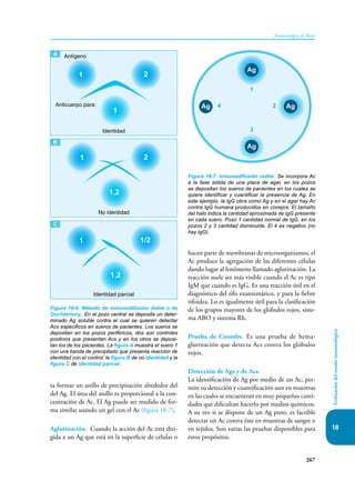 267
Inmunología de Rojas
Evaluación
del
estado
inmunológico
18
ta formar un anillo de precipitación alrededor del
del Ag. El área del anillo es proporcional a la con-
centración de Ac. El Ag puede ser medido de for-
ma similar usando un gel con el Ac (figura 18-7).
Aglutinación. Cuando la acción del Ac está diri-
gida a un Ag que está en la superficie de células o
Figura 18-6. Método de inmunodifusión doble o de
Ouchterlony. En el pozo central se deposita un deter-
minado Ag soluble contra el cual se quieren detectar
Acs específicos en sueros de pacientes. Los sueros se
depositan en los pozos periféricos, dos son controles
positivos que presentan Acs y en los otros se deposi-
tan los de los pacientes. La figura A muestra el suero 1
con una banda de precipitado que presenta reacción de
identidad con el control; la figura B de no identidad y la
figura C de identidad parcial.
Antígeno
Identidad
Anticuerpo para:
1 2
1
No identidad
1 2
1,2
Identidad parcial
1 1/2
1,2
A
B
C
hacen parte de membranas de microorganismos, el
Ac produce la agregación de las diferentes células
dando lugar al fenómeno llamado aglutinación. La
reacción suele ser más visible cuando el Ac es tipo
IgM que cuando es IgG. Es una reacción útil en el
diagnóstico del tifo exantemático, y para la fiebre
tifoidea. Lo es igualmente útil para la clasificación
de los grupos mayores de los glóbulos rojos, siste-
ma ABO y sistema Rh.
Prueba de Coombs. Es una prueba de hema-
glutinación que detecta Acs contra los glóbulos
rojos.
Detección de Ags y de Acs.
La identificación de Ag por medio de un Ac, per-
mite su detección y cuantificación aun en muestras
en las cuales se encuentran en muy pequeñas canti-
dades que dificultan hacerlo por medios químicos.
A su vez si se dispone de un Ag puro, es factible
detectar un Ac contra éste en muestras de sangre o
en tejidos. Son varias las pruebas disponibles para
estos propósitos.
Figura 18-7. Inmunodifusión radial. Se incorpora Ac
a la fase sólida de una placa de agar, en los pozos
se depositan los sueros de pacientes en los cuales se
quiere identificar y cuantificar la presencia de Ag. En
este ejemplo, la IgG obra como Ag y en el agar hay Ac
contra IgG humana producidos en conejos. El tamaño
del halo indica la cantidad aproximada de IgG presente
en cada suero. Pozo 1 cantidad normal de IgG. en los
pozos 2 y 3 cantidad disminuida. El 4 es negativo (no
hay IgG).
1
2
3
4
Ag
Ag
Ag
Ag
 