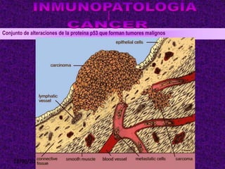 18/08/2013 19
Conjunto de alteraciones de la proteína p53 que forman tumores malignos
 
