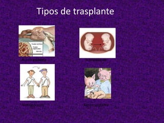Tipos de trasplante
Autotrasplante isotrasplante
Alotrasplante Xenotrasplante
 