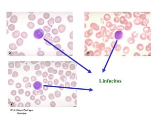 Linfocitos
I.E.S. Otero Pedrayo.
Ourense
 