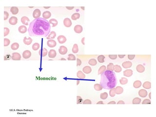 Monocito
I.E.S. Otero Pedrayo.
Ourense
 