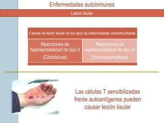 Enfermedades autoinmunes
                           Lesión tisular



Causas de lesión tisular en los tipos de enfermedades autoinmunitarias

     Reacciones de                  Reacciones de
hipersensibilidad de tipo II hipersensibilidad de tipo III
      (Citotóxicas)              (Inmunocomplejos)




                              Las células T sensibilizadas
                             frente autoantígenos pueden
                                  causar lesión tisular
 
