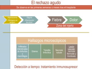 El rechazo agudo
           Se observa en las primeras semanas o meses tras el trasplante


Hiperazoemia           Oliguria
<Nitrógeno en
   sangre>
                     <Disminución
                      de orina>
                                                     Fiebre          Dolor
                                                       Zona del injerto



                             Hallazgos microscópicos
              Infiltrados                                            Lesión
            intersticiales                                          vascular,
                                        Tubulitis      Necrosis
             de linfocitos     Edema                                necrosis
                                       linfocítica      tubular
                    y                                             fibrinoide y
             macrófagos                                            trombosis



         Detección a tiempo: tratamiento inmunosupresor
 