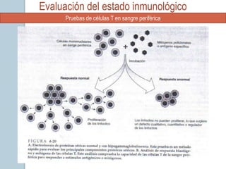 Evaluación del estado inmunológico
      Pruebas de células T en sangre periférica
 