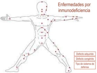 Enfermedades por
inmunodeficiencia




         Defecto adquirido
         Defecto congénito
         Tipo de sistema de
              defensa
 