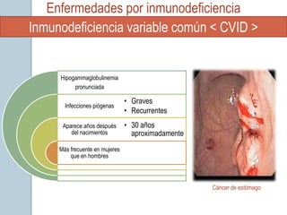 Enfermedades por inmunodeficiencia
Inmunodeficiencia variable común < CVID >


     Hipogammaglobulinemia
          pronunciada

                                • Graves
       Infecciones piógenas
                                • Recurrentes
      Aparece años después      • 30 años
         del nacimientos          aproximadamente
     Más frecuente en mujeres
         que en hombres



                                                    Cáncer de estómago
 