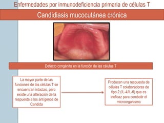 Enfermedades por inmunodeficiencia primaria de células T
              Candidiasis mucocutánea crónica




                    Defecto congénito en la función de las células T


    La mayor parte de las
                                                              Producen una respuesta de
funciones de las células T se
                                                              células T colaboradoras de
  encuentran intactas, pero
                                                                tipo 2 (IL-4/IL-6) que es
  existe una alteración de la
                                                               ineficaz para combatir el
respuesta a los antígenos de
                                                                    microorganismo
           Candida
 