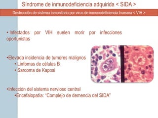 Síndrome de inmunodeficiencia adquirida < SIDA >
   Destrucción de sistema inmunitario por virus de inmunodeficiencia humana < VIH >



• Infectados por VIH suelen morir por infecciones
oportunistas


•Elevada incidencia de tumores malignos
    • Linfomas de células B
    • Sarcoma de Kaposi


•Infección del sistema nervioso central
     •Encefalopatía: “Complejo de demencia del SIDA”
 