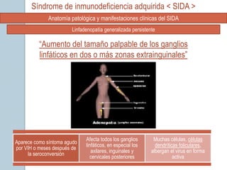 Síndrome de inmunodeficiencia adquirida < SIDA >
             Anatomía patológica y manifestaciones clínicas del SIDA
                       Linfadenopatía generalizada persistente

          “Aumento del tamaño palpable de los ganglios
          linfáticos en dos o más zonas extrainguinales”




                             Afecta todos los ganglios       Muchas células, células
Aparece como síntoma agudo
                             linfáticos, en especial los      dendríticas foliculares,
por VIH o meses después de
                                axilares, inguinales y      albergan el virus en forma
      la seroconversión
                               cervicales posteriores                  activa
 