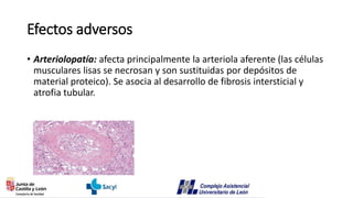 Efectos adversos
• Arteriolopatía: afecta principalmente la arteriola aferente (las células
musculares lisas se necrosan y son sustituidas por depósitos de
material proteico). Se asocia al desarrollo de fibrosis intersticial y
atrofia tubular.
 