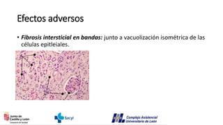 Efectos adversos
• Fibrosis intersticial en bandas: junto a vacuolización isométrica de las
células epitleiales.
 