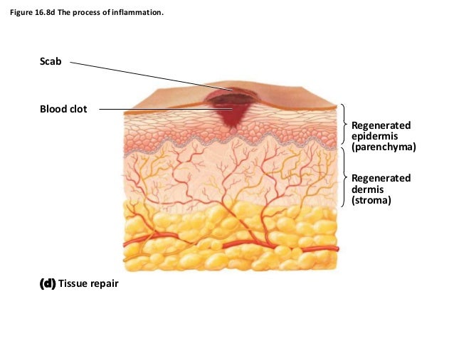 What Is A Clot Scab , Stages of Wound Healing: 4 Stages and What to ...