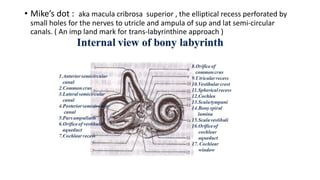 • Mike’s dot : aka macula cribrosa superior , the elliptical recess perforated by
small holes for the nerves to utricle and ampula of sup and lat semi-circular
canals. ( An imp land mark for trans-labyrinthine approach )
 