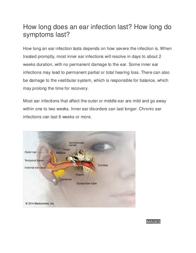 Pain Can Allergies Cause Ringing In The Ears Middle Ear Pain Does