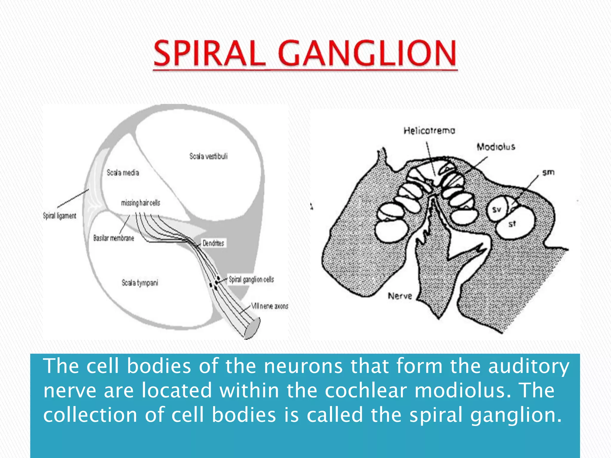The cell bodies of the neurons that form the auditory
nerve are located within the cochlear modiolus. The
collection of cell bodies is called the spiral ganglion.
 