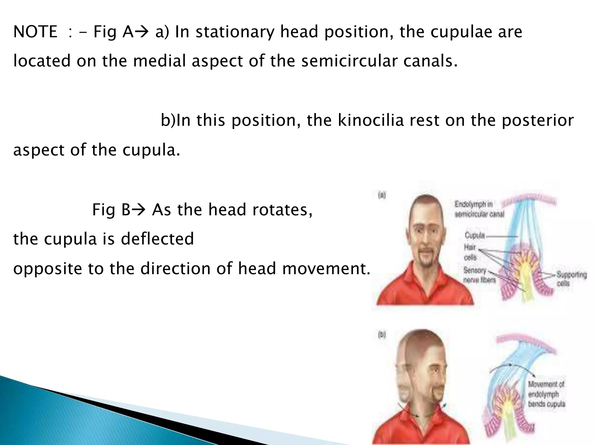 NOTE : - Fig A a) In stationary head position, the cupulae are
located on the medial aspect of the semicircular canals.
b)In this position, the kinocilia rest on the posterior
aspect of the cupula.
Fig B As the head rotates,
the cupula is deflected
opposite to the direction of head movement.
 