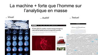 La machine + forte que l’homme sur
l’analytique en masse
… Visuel … Auditif … Textuel
 