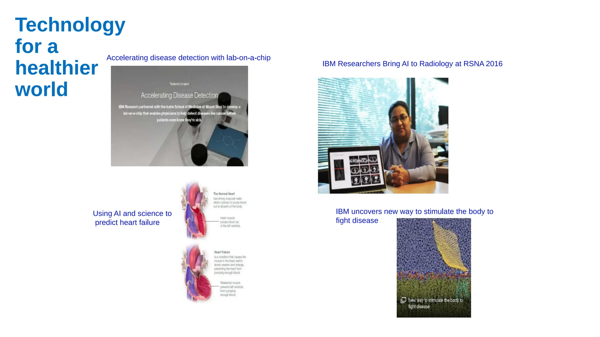 IBM Researchers Bring AI to Radiology at RSNA 2016
Accelerating disease detection with lab-on-a-chip
Using AI and science to
predict heart failure
IBM uncovers new way to stimulate the body to
fight disease
Technology
for a
healthier
world
 
