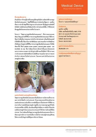 23
ที่มาของโครงการ
ปัจจุบันในการรักษาผู้ป่วยที่ประสบอุบัติเหตุหรือมีความผิดปกติด้านกระดูก
สันหลังส่วนคอและอก วัสดุที่ใช้มีต้นทุนราคาต่อหน่วยที่สูงมาก และต้อง
พึ่งพาการนำ�เข้าวัสดุที่ได้มาตรฐานจากต่างประเทศ ซึ่งวัสดุอุปกรณ์ชนิดนี้
ยังไม่มีการผลิตในประเทศจึงต้องนำ�เข้าจากต่างประเทศทั้งสิ้น ทำ�ให้ประเทศ
ต้องสูญเสียเงินและงบประมาณเป็นจำ�นวนมาก
โครงการ “วัสดุดามกระดูกสันหลังส่วนคอและอก” เป็นการออกแบบและ
พัฒนาวัสดุ-อุปกรณ์ที่ใช้ในการดามกระดูกสันหลังส่วนคอและอก ให้มีราคา
ที่ถูกกว่าเพื่อเป็นการทดแทนการนำ�เข้าจากต่างประเทศ พร้อมทั้งช่วยแพทย์
ผ่าตัดได้ง่ายขึ้น ใช้เวลาในการผ่าตัดน้อยลง และบาดแผลในการผ่าตัดเล็กลง
หรือน้อยลงโดยอุปกรณ์ที่ใช้ในการดามกระดูกสันหลังส่วนคอและอกที่บริษัท
พัฒนาขึ้น ได้แก่ pedicle screw system, cervical plate system  และ
Si-ARSD rib bar ซึ่งการพัฒนาโครงการดังกล่าวขึ้นเองภายในประเทศ
นอกจากจะสามารถลดการนำ�เข้าอุปกรณ์ด้านออร์โธปิดิกส์ ที่มีราคาแพง
จากต่างประเทศ ผลิตภัณฑ์ดังกล่าวยังมีศักยภาพและโอกาสทางการตลาด
สำ�หรับการส่งออกไปยังต่างประเทศ โดยเฉพาะอย่างยิ่งในประชาคม
เศรษฐกิจอาเซียน
รูปแบบการสนับสนุน:
โครงการ “แปลงเทคโนโลยีเป็นทุน”
.............................................................
ดำ�เนินการ:
คุณวินิจ ฤทธิ์ฉิ้ม
บริษัท เซอร์วิสเอ็นจิเนียริ่ง (1987) จำ�กัด  
33/11-12 ถนนเทพารักษ์ ตำ�บลบางปลา
อำ�เภอบางพลี จังหวัดสมุทรปราการ
โทศัพท์: 02-312 5135
โทรสาร: 02-312 3310
.............................................................
มูลค่าการลงทุนเริ่มต้น:
38,000,000 บาท
.............................................................
การคุ้มครองทรัพย์สินทางปัญญา:
อยู่ระหว่างดำ�เนินการ
ผลประโยชน์ทางเศรษฐกิจและสังคม
วัสดุดามกระดูกสันหลังส่วนคอและอกถือเป็นโครงการนวัตกรรมที่สามารถ
ลดการนำ�เข้าสินค้าจากต่างประเทศ ด้วยมาตรฐานรองรับในระดับสากล
และส่วนประกอบบางส่วนที่สามารถผลิตได้เองภายในประเทศ ทำ�ให้มีความ
สามารถในการแข่งขันในตลาดภูมิภาคสูงขึ้น สามารถขยายฐานลูกค้าไปยัง
ต่างประเทศได้มากยิ่งขึ้น อันจะส่งผลให้ธุรกิจมีอัตราการเติบโต ซึ่งจะเกิด
ผลดีต่อเศรษฐกิจโดยรวมของประเทศและทำ�ให้เกิดภาพลักษณ์ที่ดีต่อ
ประเทศ ในทางสังคมนั้นวัสดุดามกระดูกสันหลังส่วนคอและอกเป็นการ
พัฒนาอุปกรณ์ทางการแพทย์เพื่อการเพิ่มโอกาสของผู้ประสบอุบัติเหตุ
ให้สามารถเข้าถึงอุปกรณ์ที่มีคุณภาพในราคาไม่แพง
 