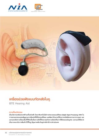 42
เครื่องช่วยฟังแบบทัดหลังใบหู
BTE Hearing Aid
ความเป็นนวัตกรรม
เป็นนวัตกรรมระดับประเทศด้านเครื่องช่วยฟัง โดยอาศัยเทคโนโลยีการประมวลผลแบบดิจิตอล (Digital Signal Processing; DSP) ใน
การออกแบบระบบแปลงสัญญาณจากเสียงปกติให้เป็นระบบดิจิตอล และพัฒนาโปรแกรมให้สามารถขจัดเสียงรบกวนจากภายนอก และ
แยกแยะระดับความถี่ของเสียงที่ได้รับเพื่อเพิ่มความดังที่ให้เหมาะสมกับความผิดปกติในการได้ยินของแต่ละบุคคล ออกแบบให้มีขนาด
เล็กมากเหมาะกับการเสียบค้างไว้ที่ใบหู มีคุณภาพเดียวกับอุปกรณ์นำ�เข้าจากต่างประเทศ
 