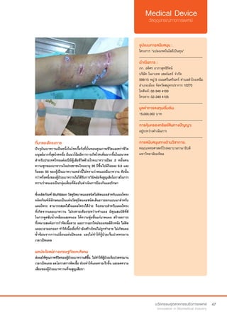 47
ที่มาของโครงการ
ปัจจุบันเบาหวานเป็นหนึ่งในโรคเรื้อรังที่บั่นทอนคุณภาพชีวิตและคร่าชีวิต
มนุษย์มากที่สุดโรคหนึ่ง มีแนวโน้มอัตราการเกิดโรคเพิ่มมากขึ้นในอนาคต
สำ�หรับประเทศไทยแต่ละปีมีผู้เสียชีวิตด้วยโรคเบาหวานปีละ 2 หมื่นคน
ความชุกของเบาหวานในประชาชนไทยอายุ 35 ปีขึ้นไปมีร้อยละ 9.6 และ
ร้อยละ 50 ของผู้เป็นเบาหวานเหล่านี้ไม่ทราบว่าตนเองมีเบาหวาน ดังนั้น
กว่าครึ่งหนึ่งของผู้ป่วยเบาหวานไม่ได้รับการวินิจฉัยจึงสูญเสียโอกาสในการ
ทราบว่าตนเองเป็นกลุ่มเสี่ยงที่ต้องรีบดำ�เนินการป้องกันและรักษา
ซึ่งผลิตภัณฑ์ BluRibbon วัสดุปิดบาดแผลชนิดไม่ติดแผลสำ�หรับแผลโพรง
ผลิตภัณฑ์มีลักษณะเป็นแผ่นวัสดุปิดแผลชนิดเส้นยาวออกแบบมาสำ�หรับ
แผลโพรง สามารถสอดใส่ในแผลโพรงได้ง่าย จึงเหมาะสำ�หรับแผลโพรง
ที่เกิดจากแผลเบาหวาน ไม่ระคายเคืองระหว่างทำ�แผล มีคุณสมบัติที่ดี
ในการดูดซับน้ำ�เหลืองและหนอง ให้ความชุ่มชื้นแก่บาดแผล สร้างสภาวะ
ที่เหมาะสมต่อการกำ�จัดเนื้อตาย และการงอกใหม่ของเซลล์ผิวหนัง ไม่ติด
แผลเวลาลอกออก ทำ�ให้เนื้อเยื่อที่กำ�ลังสร้างใหม่ไม่ถูกทำ�ลาย ไม่เกิดแผล
ซ้ำ�ซ้อนจากการเปลี่ยนแผ่นปิดแผล และไม่ทำ�ให้ผู้ป่วยเจ็บปวดทรมาน
เวลาเปิดแผล  
ผลประโยชน์ทางเศรษฐกิจและสังคม
ส่งผลให้คุณภาพชีวิตของผู้ป่วยเบาหวานดีขึ้น ไม่ทำ�ให้ผู้ป่วยเจ็บปวดทรมาน
เวลาเปิดแผล ลดโอกาสการติดเชื้อ ช่วยทำ�ให้แผลหายเร็วขึ้น และลดความ
เสี่ยงของผู้ป่วยเบาหวานที่จะสูญเสียขา
รูปแบบการสนับสนุน :
โครงการ “แปลงเทคโนโลยีเป็นทุน”
.............................................................
ดำ�เนินการ :
ภก. อดิศร อาภาสุทธิรัตน์
บริษัท โนวาเทค เฮลธ์แคร์ จำ�กัด
599/15 หมู่ 5 ถนนศรีนครินทร์ ตำ�บลสำ�โรงเหนือ
อำ�เภอเมือง จังหวัดสมุทรปราการ 10270	
โทศัพท์: 02-349 4100
โทรสาร: 02-349 4105
.............................................................
มูลค่าการลงทุนเริ่มต้น:
15,000,000 บาท
.............................................................
การคุ้มครองทรัพย์สินทางปัญญา:
อยู่ระหว่างดำ�เนินการ
.............................................................
การสนับสนุนทางด้านวิชาการ:
คณะแพทยศาสตร์โรงพยาบาลรามาธิบดี
มหาวิทยาลัยมหิดล
 