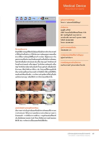 49
ที่มาของโครงการ
ปัจจุบันได้มีการประยุกต์ใช้เทคโนโลยีและเครื่องมือวิเคราะห์ทางวิทยาศาสตร์
มาใช้กับธุรกิจเครื่องสำ�อาง ทำ�ให้นวัตกรรมการผลิตและคุณภาพของเครื่อง
สำ�อางได้รับการปรับปรุงให้ดีขึ้นอย่างก้าวกระโดด ซึ่งผู้ประกอบการใน
อุตสาหกรรมเครื่องสำ�อางของไทยต้องลงทุนด้านเครื่องมือวิเคราะห์ทดสอบ
โดยนำ�เข้าเครื่องมือจากต่างประเทศเช่นเครื่องVisioscan®
สำ�หรับวิเคราะห์
โครงสร้างตาข่ายของผิว เครื่อง Sebum®
สำ�หรับวัดความมันของผิว เครื่อง
Visia®
สำ�หรับวิเคราะห์สภาพผิวบนใบหน้า ริ้วรอย จุดด่างดำ� เครื่องมือนำ�เข้า
มีราคาแพง มีข้อจำ�กัดด้านการใช้งาน เช่น โปรแกรมที่ใช้ควบคุมมีคำ�สั่ง
เป็นภาษาอังกฤษทั้งหมด โปรแกรมมีการจำ�กัดสิทธิ์การใช้งานหรือใช้ได้กับ
คอมพิวเตอร์เพียงเครื่องเดียว หากเกิดความชำ�รุดเสียหายทั้งตัวเครื่องมือ
และโปรแกรมควบคุม จะต้องใช้บริการจากวิศวกรของบริษัทเท่านั้น
รูปแบบการสนับสนุน:
โครงการ “แปลงเทคโนโลยีเป็นทุน”
.............................................................
ดำ�เนินการ:
คุณชูชีพ อภิรักษ์  
บริษัท โกลบอลไซเอ็นทิฟิคเซอร์วิสเซส จำ�กัด
89/1 ซอยรัชฎภัณฑ์ ถนนราชปรารภ
แขวงมักกะสัน เขตราชเทวี กรุงเทพฯ 10400
โทศัพท์: 02-642 6060
โทรสาร: 02-248 2021
.............................................................
มูลค่าการลงทุนเริ่มต้น:
150,000,000 บาท
.............................................................
การคุ้มครองทรัพย์สินทางปัญญา:
อยู่ระหว่างดำ�เนินการ
.............................................................
การสนับสนุนทางด้านวิชาการ:
คณะวิทยาศาสตร์ จุฬาลงกรณ์มหาวิทยาลัย
ผลประโยชน์ทางเศรษฐกิจและสังคม
เป็นการลดการนำ�เข้าอุปกรณ์และเครื่องมือวิเคราะห์ทดสอบที่มีราคาแพง
จากต่างประเทศ ซึ่งในทางการแพทย์สามารถนำ�มาติดตามการลดการ
อักเสบของผิว การเกิดผื่นจากการแพ้ต่างๆ การยุบตัวของส่วนที่ผิดปกติ
เช่น เส้นเลือดขอด ขนครุฑ ปานดำ� คีรอย หรือติดตามความสม่ำ�เสมอของ
สีผิวได้ เช่น การเกิดกลากเกลื้อนและสะเก็ดเงินได้อีกด้วย
 