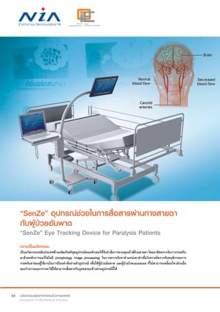 60
“SenZe” อุปกรณ์ช่วยในการสื่อสารผ่านทางสายตา
กับผู้ป่วยอัมพาต
“SenZe” Eye Tracking Device for Paralysis Patients
ความเป็นนวัตกรรม
เป็นนวัตกรรมระดับประเทศด้านผลิตภัณฑ์ชุดอุปกรณ์คอมพิวเตอร์ที่รับคำ�สั่งการควบคุมเม้าส์ด้วยสายตา โดยอาศัยตรวจจับการกระพริบ
ตาด้วยหลักการมอร์โฟโลยี (morphology image processing) ในการตรวจจับหาตำ�แหน่งตาดำ�เพื่อวิเคราะห์ตรวจจับพฤติกรรมการ
กระพริบตาของผู้ใช้งานในการป้อนคำ�สั่งผ่านตัวอุปกรณ์ เพื่อให้ผู้ป่วยอัมพาต และผู้ป่วยโรคเอแอลเอส ที่ไม่สามารถเคลื่อนไหวส่วนอื่น
ของร่างกายนอกจากตาได้ให้สามารถสื่อสารกับบุคคลรอบข้างผ่านอุปกรณ์นี้ได้
 