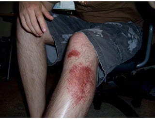 Innovation Parkour for Information Architects