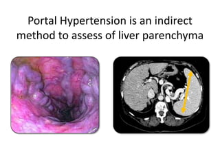 Innovations in liver surgery for Hepatocellular Carcinoma | PPTX