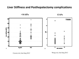 Liver Stiffness and Posthepatectomy complications
Cescon et al, Ann Surg 2012 Wong et al, Ann Surg 2013
>16 kPa 12 kPa
 