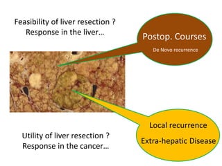 De Novo recurrence
Postop. Courses
Local recurrence
Extra-hepatic Disease
Utility of liver resection ?
Response in the cancer…
Feasibility of liver resection ?
Response in the liver…
 