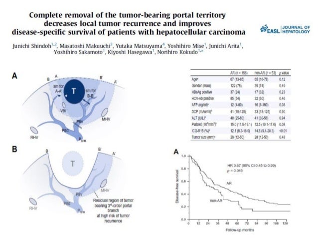 meld liver transplant meld liver transplant
