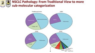NSCLC Pathology: From Traditional View to more
sub-molecular categorization
 