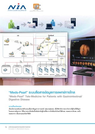 16
“Meds-Pearl” ระบบสื่อสารข้อมูลการแพทย์ทางไกล
“Meds-Pearl” Tele-Medicine for Patients with Gastrointestinal/
Digestive Disease
ความเป็นนวัตกรรม
เป็นนวัตกรรมระดับประเทศด้านระบบสื่อสารข้อมูลทางการแพทย์ (tele-medicine) เพื่อใช้สำ�หรับการตรวจวิเคราะห์ผู้ป่วยที่มีปัญหา
ในระบบทางเดินอาหาร ใช้ในการตรวจวินิจฉัยเบื้องต้นสำ�หรับผู้ป่วยที่มีอาการใกล้เคียงกับโรคลำ�ไส้อักเสบ หลอดอาหารอักเสบ มะเร็ง
หลอดอาหาร เนื้องอกและมะเร็งลำ�ไส้เล็ก
 