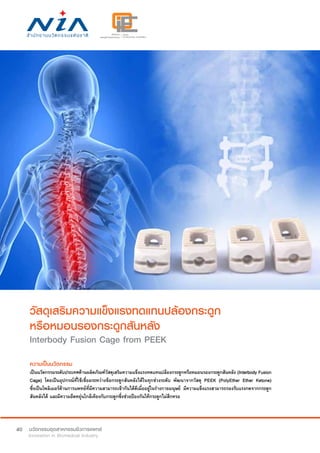 40
วัสดุเสริมความแข็งแรงทดแทนปล้องกระดูก
หรือหมอนรองกระดูกสันหลัง
Interbody Fusion Cage from PEEK
ความเป็นนวัตกรรม
เป็นนวัตกรรมระดับประเทศด้านผลิตภัณฑ์วัสดุเสริมความแข็งแรงทดแทนปล้องกระดูกหรือหมอนรองกระดูกสันหลัง (Interbody Fusion
Cage) โดยเป็นอุปกรณ์ที่ใช้เชื่อมระหว่างข้อกระดูกสันหลังได้ในทุกช่วงระดับ พัฒนาจากวัสดุ PEEK (PolyEther Ether Ketone)
ซึ่งเป็นโพลิเมอร์ด้านการแพทย์ที่มีความสามารถเข้ากันได้ดีเมื่ออยู่ในร่างกายมนุษย์ มีความแข็งแรงสามารถรองรับแรงกดจากกระดูก
สันหลังได้ และมีความยืดหยุ่นใกล้เคียงกับกระดูกซึ่งช่วยป้องกันให้กระดูกไม่สึกหรอ
 