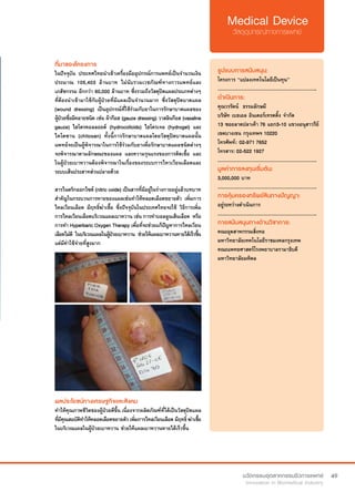 49
ที่มาของโครงการ
ในปัจจุบัน ประเทศไทยนำ�เข้าเครื่องมืออุปกรณ์การแพทย์เป็นจำ�นวนเงิน
ประมาณ 105,403 ล้านบาท ไม่นับรวมเวชภัณฑ์ทางการแพทย์และ
เภสัชกรรม อีกกว่า 60,000 ล้านบาท ซึ่งรวมถึงวัสดุปิดแผลประเภทต่างๆ
ที่ต้องนำ�เข้ามาใช้กับผู้ป่วยที่มีแผลเป็นจำ�นวนมาก ซึ่งวัสดุปิดบาดแผล
(wound dressing) เป็นอุปกรณ์ที่ใช้ร่วมกับยาในการรักษาบาดแผลของ
ผู้ป่วยซึ่งมีหลายชนิด เช่น ผ้าก๊อส (gauze dressing) วาสลินก๊อส (vasaline
gauze) ไฮโดรคอลลอยด์ (hydrocolloids) ไฮโดรเจล (hydrogel) และ
ไคโตซาน (chitosan) ทั้งนี้การรักษาบาดแผลโดยวัสดุปิดบาดแผลนั้น
แพทย์จะเป็นผู้พิจารณาในการใช้ร่วมกับยาเพื่อรักษาบาดแผลชนิดต่างๆ
จะพิจารณาตามลักษณะของแผล และความรุนแรงของการติดเชื้อ และ
ในผู้ป่วยเบาหวานต้องพิจารณาในเรื่องของระบบการไหวเวียนเลือดและ
ระบบเส้นประสาทส่วนปลายด้วย
สารไนตริกออกไซด์ (nitric oxide) เป็นสารที่มีอยู่ในร่างกายอยู่แล้วบทบาท
สำ�คัญในกระบวนการหายของแผลเช่นทำ�ให้หลอดเลือดขยายตัว เพิ่มการ
ไหลเวียนเลือด มีฤทธิ์ฆ่าเชื้อ ซึ่งปัจจุบันในประเทศไทยจะใช้ วิธีการเพิ่ม
การไหลเวียนเลือดบริเวณแผลเบาหวาน เช่น การทำ�บอลลูนเส้นเลือด  หรือ  
การทำ� Hyperbaric Oxygen Therapy เพื่อที่จะช่วยแก้ปัญหาการไหลเวียน
เลือดไม่ดี ในบริเวณแผลในผู้ป่วยเบาหวาน ช่วยให้แผลเบาหวานหายได้เร็วขึ้น
แต่มีค่าใช้จ่ายที่สูงมาก
รูปแบบการสนับสนุน:
โครงการ “แปลงเทคโนโลยีเป็นทุน”
.............................................................
ดำ�เนินการ:
คุณวรรัตน์  ธรรมลักษมี  	
บริษัท เบธเอล อินเตอร์เทรดดิ้ง จำ�กัด
13 ซอยลาดปลาเค้า 76 แยก3-10 แขวงอนุสาวรีย์
เขตบางเขน กรุงเทพฯ 10220    
โทรศัพท์: 	02-971 7652	 	 	
โทรสาร: 02-522 1927    
.............................................................
มูลค่าการลงทุนเริ่มต้น:
3,000,000 บาท
.............................................................
การคุ้มครองทรัพย์สินทางปัญญา:
อยู่ระหว่างดำ�เนินการ
.............................................................
การสนับสนุนทางด้านวิชาการ:
คณะอุตสาหกรรมสิ่งทอ
มหาวิทยาลัยเทคโนโลยีราชมงคลกรุงเทพ
คณะแพทยศาสตร์โรงพยาบาลรามาธิบดี
มหาวิทยาลัยมหิดล
ผลประโยชน์ทางเศรษฐกิจและสังคม
ทำ�ให้คุณภาพชีวิตของผู้ป่วยดีขึ้น เนื่องจากผลิตภัณฑ์ที่ได้เป็นวัสดุปิดแผล
ที่มีคุณสมบัติทำ�ให้หลอดเลือดขยายตัว เพิ่มการไหลเวียนเลือด มีฤทธิ์ ฆ่าเชื้อ
ในบริเวณแผลในผู้ป่วยเบาหวาน ช่วยให้แผลเบาหวานหายได้เร็วขึ้น
 