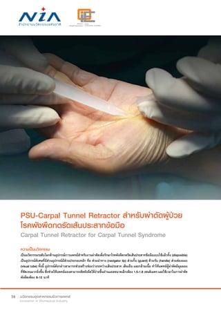58
PSU-Carpal Tunnel Retractor สำ�หรับผ่าตัดผู้ป่วย
โรคพังผืดกดรัดเส้นประสาทข้อมือ
Carpal Tunnel Retractor for Carpal Tunnel Syndrome
ความเป็นนวัตกรรม
เป็นนวัตกรรมระดับโลกด้านอุปกรณ์การแพทย์สำ�หรับงานผ่าตัดเพื่อรักษาโรคพังผืดกดรัดเส้นประสาทข้อมือแบบใช้แล้วทิ้ง (disposible)
เป็นอุปกรณ์พิเศษที่มีส่วนอุปกรณ์มีส่วนประกอบหลัก คือ ส่วนนำ�ทาง (navigator tip) ส่วนกั้น (guard) ด้ามจับ (handle) ส่วนช่องมอง
(visual tube) ทั้งนี้ อุปกรณ์ดังกล่าวสามารถช่วยสร้างช่องว่างระหว่างเส้นประสาท เส้นเอ็น และกล้ามเนื้อ ทำ�ให้แพทย์ผู้ผ่าตัดมีมุมมอง
ที่ชัดเจนมากยิ่งขึ้น ซึ่งช่วยให้แพทย์มองสามารถตัดพังผืดได้ง่ายขึ้นผ่านแผลขนาดเล็กเพียง 1.5-1.8 เซนติเมตร และใช้เวลาในการผ่าตัด
พังผืดเพียง 8-10 นาที
 