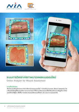 6
ระบบการวิเคราะห์สภาพบาดแผลแบบออนไลน์
Online Analyzer for Wound Assessment
ความเป็นนวัตกรรม
เป็นนวัตกรรมระดับโลกด้านระบบการวิเคราะห์สภาพบาดแผลแบบออนไลน์ การประเมินสภาพบาดแผล (Wound Assessment) โดย
อาศัยเทคโนโลยีระบุพื้นที่บาดแผลด้วยการถ่ายภาพบาดแผล ทำ�ให้สามารถวัดขนาดแผลบนพื้นผิวโค้งและเก็บรวบรวมข้อมูลด้านการรักษา
และบันทึกประวัติผู้ป่วย เพื่อใช้ในการประเมินบาดแผลและติดตามแผลเรื้อรังต่าง เช่น แผลเบาหวานและแผลกดทับ
 