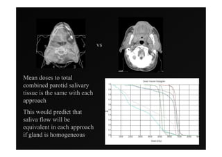 vs




Mean doses to total
combined parotid salivary
tissue is the same with each
approach
This would predict that
saliva flow will be
equivalent in each approach
if gland is homogeneous
 