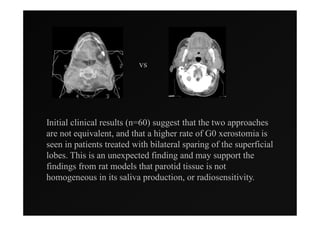 vs




Initial clinical results (n=60) suggest that the two approaches
are not equivalent, and that a higher rate of G0 xerostomia is
seen in patients treated with bilateral sparing of the superficial
lobes. This is an unexpected finding and may support the
findings from rat models that parotid tissue is not
homogeneous in its saliva production, or radiosensitivity.
 