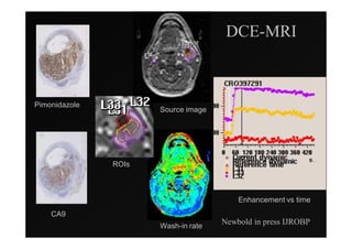 DCE-MRI



Pimonidazole
                      Source image




               ROIs



                                         Enhancement vs time
    CA9
                      Wash-in rate
                                     Newbold in press IJROBP
 