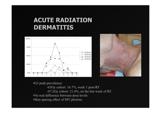 ACUTE RADIATION
         DERMATITIS
100.0%




75.0%



                                                       G3 63.0Gy
                                                       G3 67.2Gy
50.0%
                                                       G2 63.0Gy
                                                       G2 67.2Gy



25.0%




 0.0%
         1   2   3   4   5   6   7   8   9   10   14




         •G3 peak prevalence:
                   -63Gy cohort: 16.7%, week 1 post-RT
                   -67.2Gy cohort: 21.4%, on the last week of RT.
         •No real difference between dose levels
         •Skin sparing effect of MV photons
 