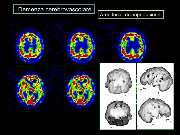 Innovazioni metodologiche di imaging funzionale