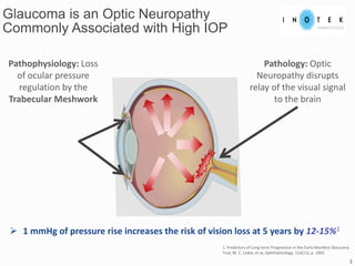 Glaucoma is an Optic Neuropathy
Commonly Associated with High IOP
3
 1 mmHg of pressure rise increases the risk of vision loss at 5 years by 12-15%1
1. Predictors of Long-term Progression in the Early Manifest Glaucoma
Trial, M. C. Leske, et al, Ophthalmology, 114(11), p. 1965
Pathophysiology: Loss
of ocular pressure
regulation by the
Trabecular Meshwork
Pathology: Optic
Neuropathy disrupts
relay of the visual signal
to the brain
 
