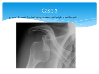 Case 2
32 year old male, football injury, presents with right shoulder pain

 