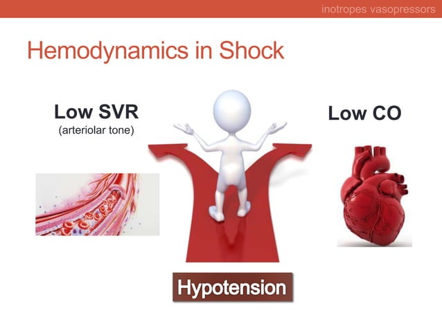 Rational choice of inotropes and vasopressors in intensive care unit