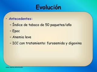 www.reeme.arizona.edu
Evolución
• Antecedentes:
– Índice de tabaco de 50 paquetes/año
– Epoc
– Anemia leve
– ICC con tratamiento: furosemida y digoxina
 