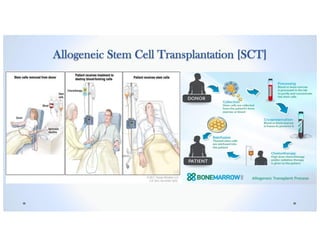 Allogeneic Stem Cell Transplantation [SCT]
 